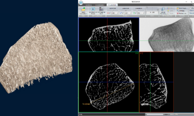 显微CT:解密骨骼微结构的科学利器